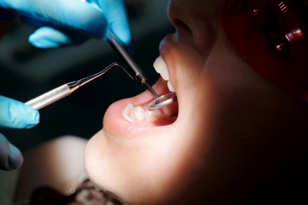 Scaling and root planing deep gum cleaning performed by a dentist at Yonge Wellesley Dental in Toronto